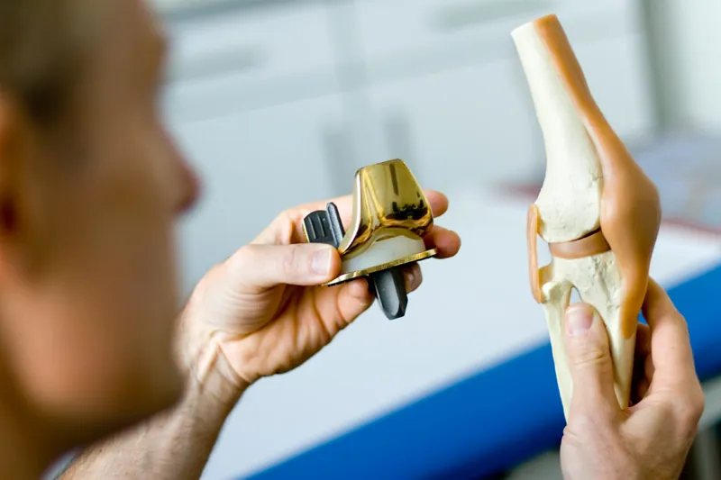 Arzt hält eine Knieprothese neben ein anatomisches Kniemodell